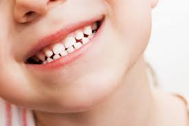 5 аргументов в пользу лечения молочных зубов
